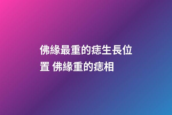 佛緣最重的痣生長位置 佛緣重的痣相